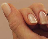 Заусенцы на пальцах рук: причины, лечение, профилактика Под ногтями на руках заусенцы